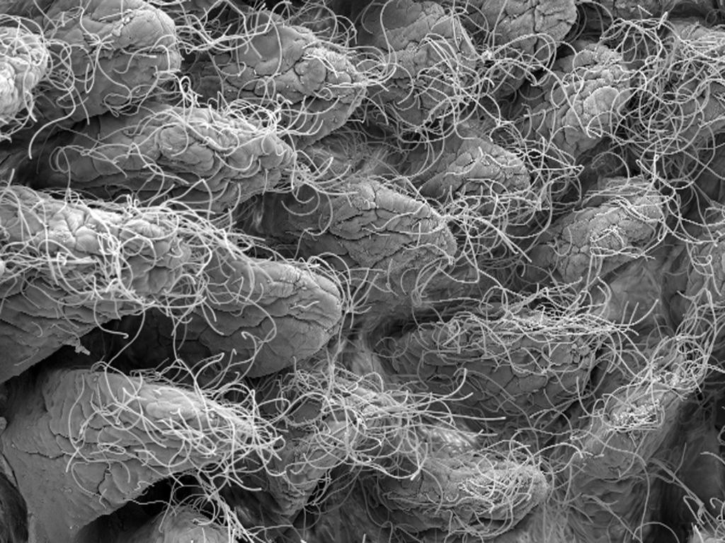 צילום באמצעות מיקרוסקופ אלקטרונים, המציג מעי דק של עכבר בריא, בו מקיפים החיידקים (החוטים) את סיסי המעי (הבליטות). מבנה המעי הדק בבני-אדם דומה מאוד.